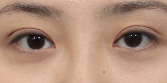 Trước
